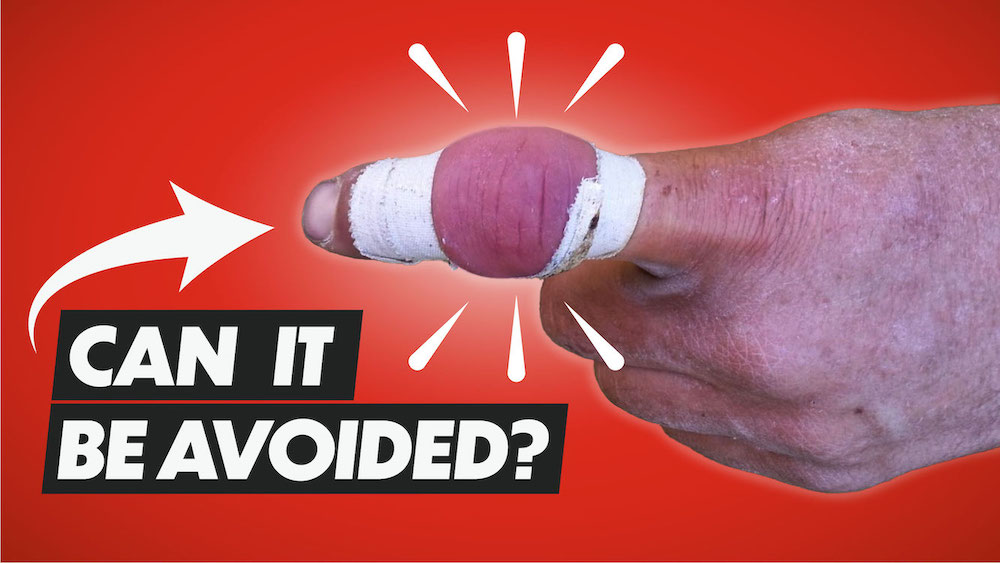 How to Avoid Injuries in Climbing (2 Top Tips!)