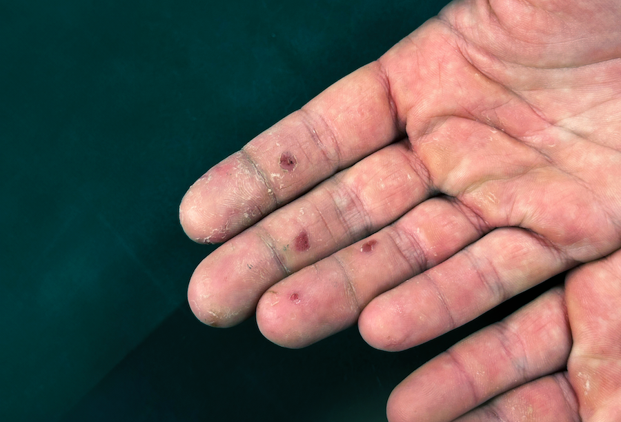 How to choose skincare for climbing