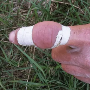 I currently have an injury.